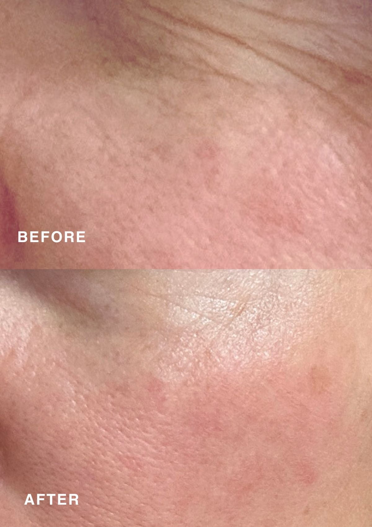 Skin Butter