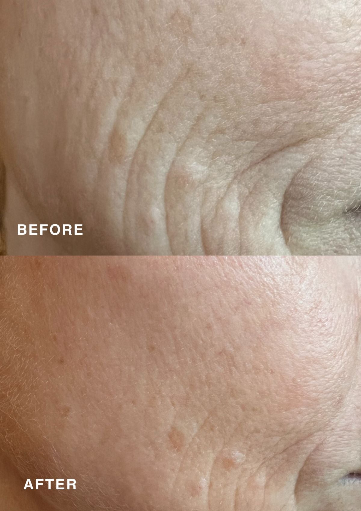 Ennen ja jälkeen -kuva Niki Newd® Skin Cream -voiteen vaikutuksista – yläkuvassa iho näyttää samealta ja juonteet erottuvat, alakuva paljastaa sileämmän, kirkkaamman ja hehkuvamman ihon.