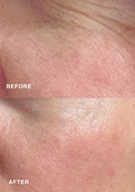 Before and after results with Niki Newd® Skin Butter – in the top image skin appears dull with visible fine lines, in the bottom it looks smoother, brighter, and naturally radiant.